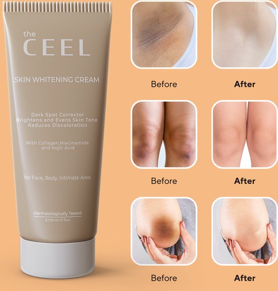 Ceel Natural Skin Brightening Cream-50ml - Skin Brightening & Even Tone | Added with Glutathione and Kojic Acid