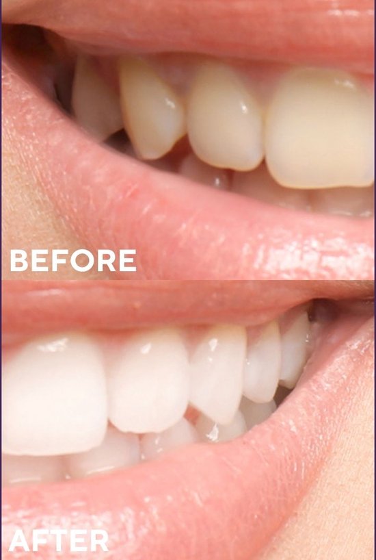 Ceel Activated Purple Carbon Powder-50g - Teeth Whitening & Oral Detox